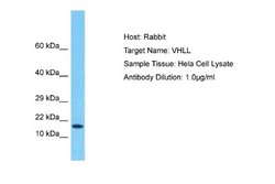 VHLL Rabbit anti-Human, Polyclonal, Novus Biologicals 0.1 mL | Buy Online | Novus Biologicals | Fisher Scientific